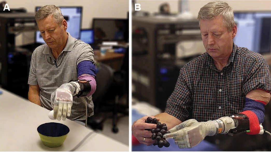 Advances in lower limb prosthetics - Medical Design and Outsourcing