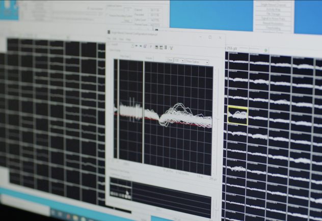 neural signals from blackrock neuroport system